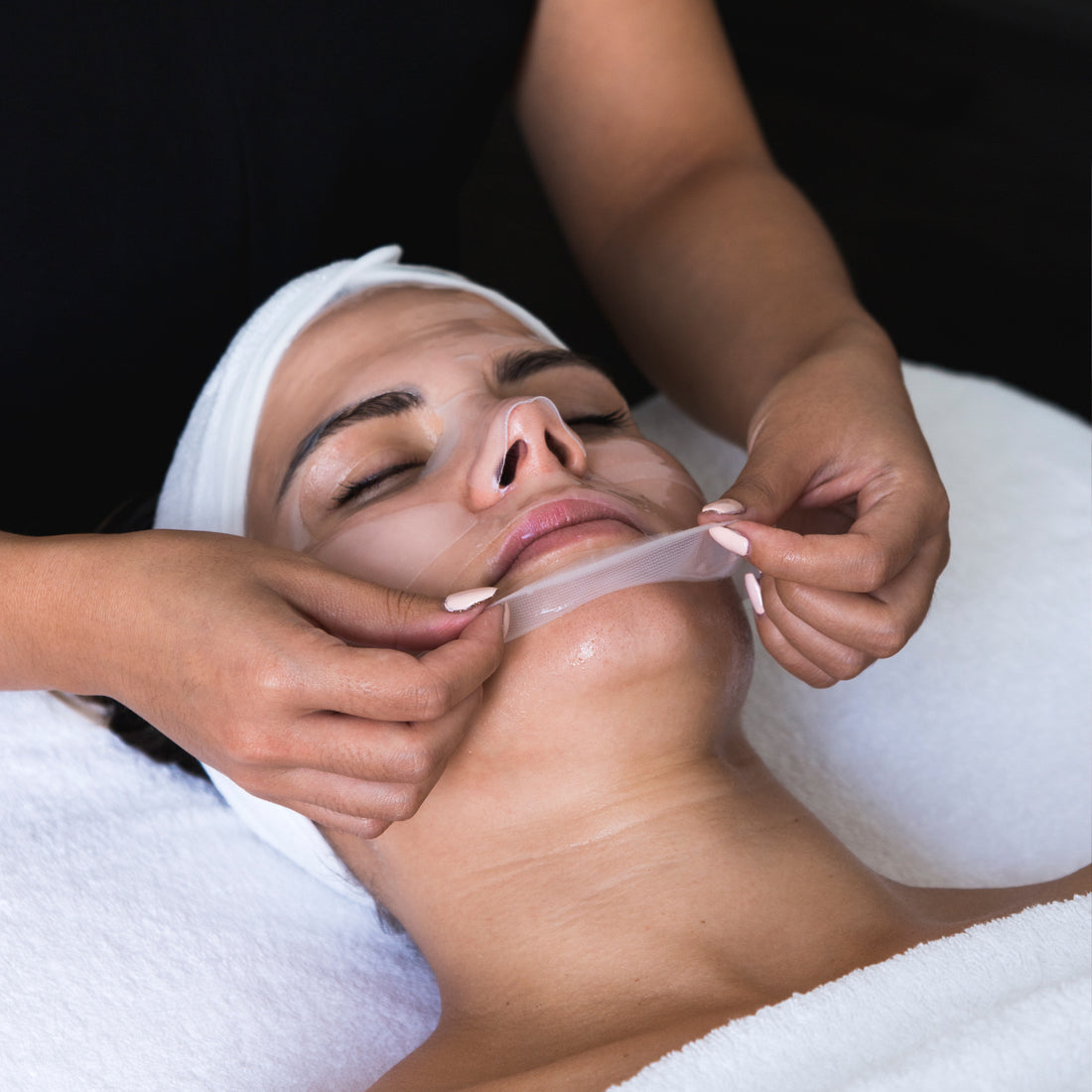 Skin Peels