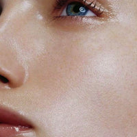 Skin Peels