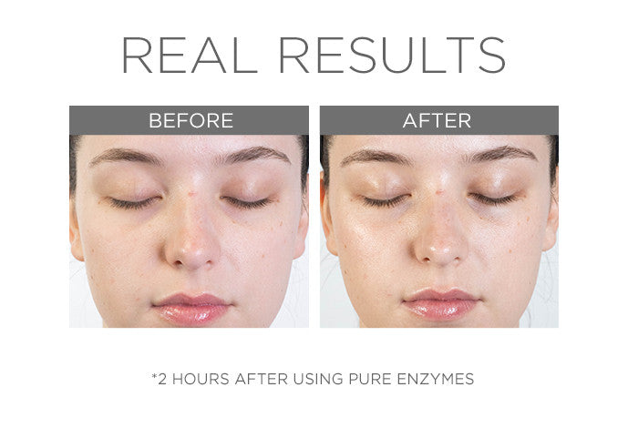 Cosmedix Pure Enzymes