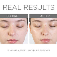 Cosmedix Pure Enzymes