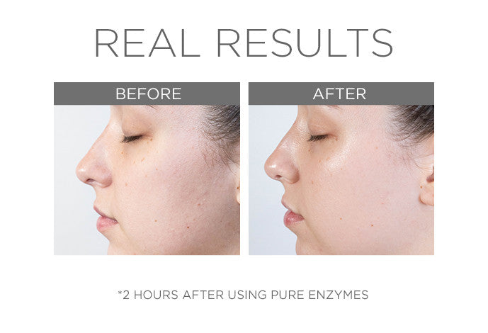 Cosmedix Pure Enzymes