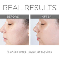 Cosmedix Pure Enzymes
