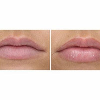 PCA Hyaluronic Acid Lip Booster
