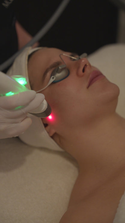 Laser Genesis – Black Friday Exclusive Buy 3, Get 1 Free (Save $399)