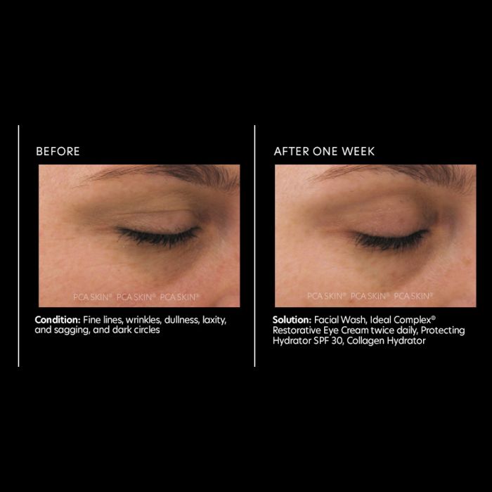 PCA Ideal Complex Revitalizing Eye Gel