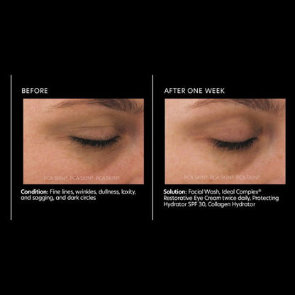 PCA Ideal Complex Revitalizing Eye Gel