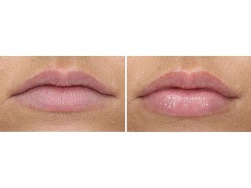 PCA Hyaluronic Acid Lip Booster